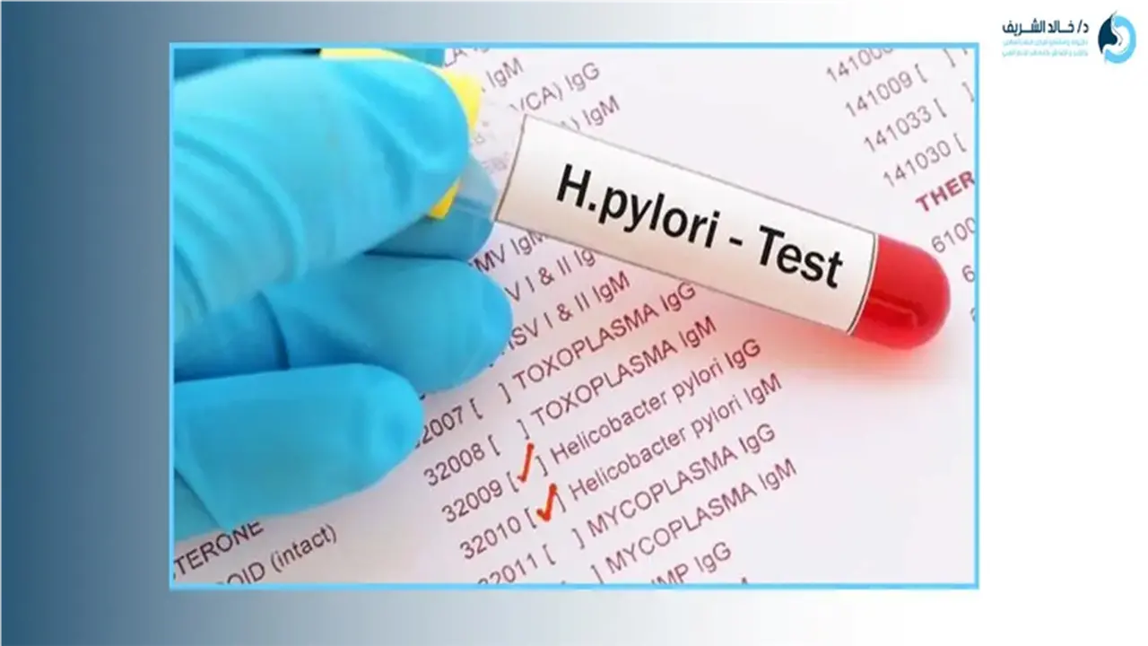 أسعار وأساليب تحليل جرثومة المعدة: كيف تختار الفحص المناسب وتحضر له؟